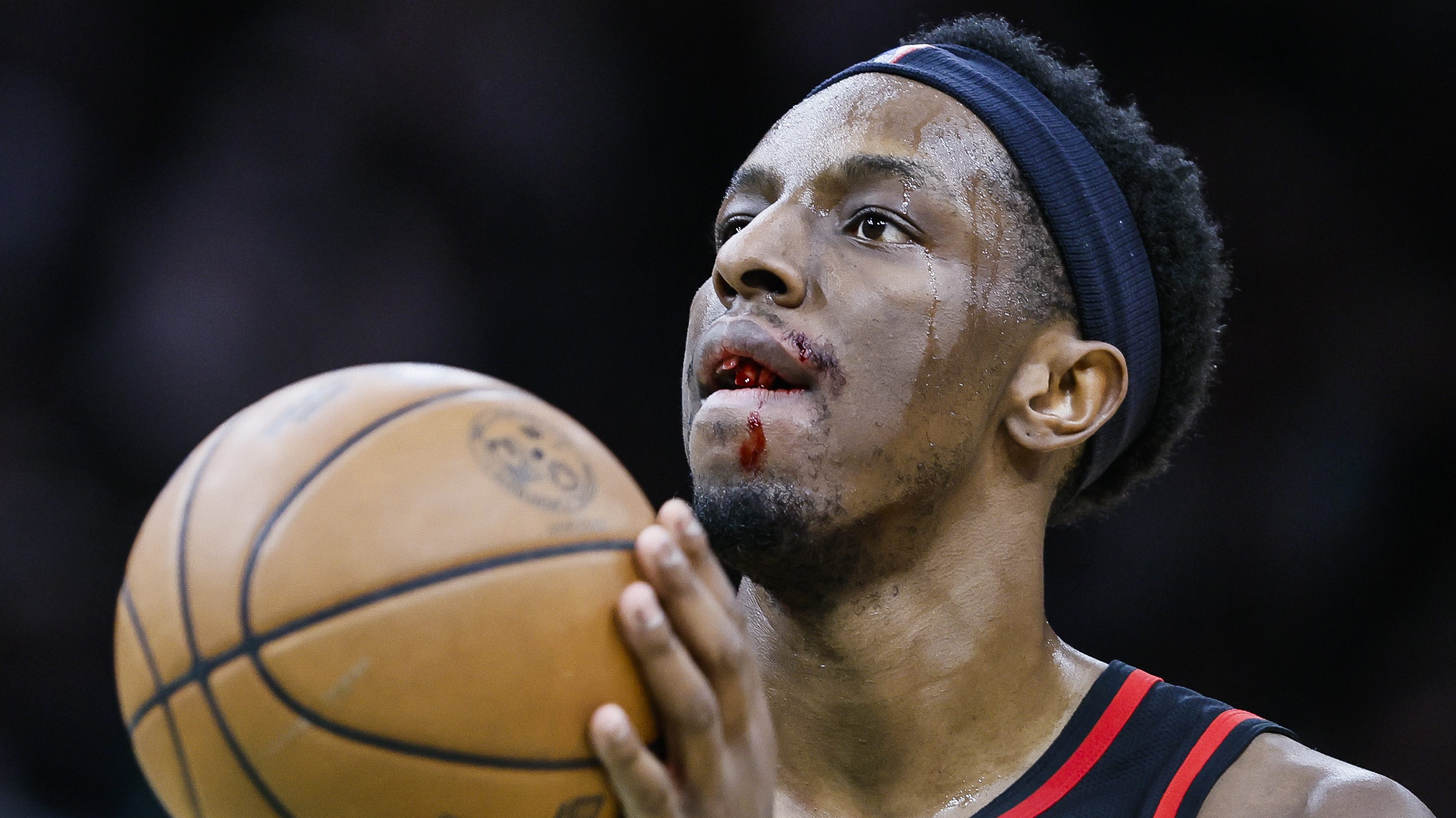 Onyeka Okongwu a balesete után.