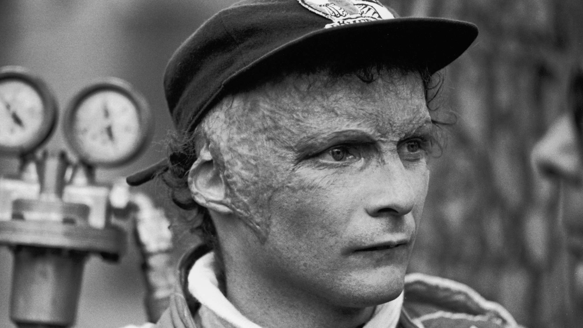 Austrian Grand Prix racing car driver Niki Lauda watches, late 1970s. Lauda was badly burned in a crash during the 1976 season but returned to race shortly afterwards. (Photo by Robert Riger/Getty Images)